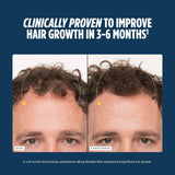 Nutrafol Men Hair Growth Supplements, Ages 18-49 , 120 capsules  ( pack of 3 )